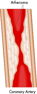 lower cholesterol